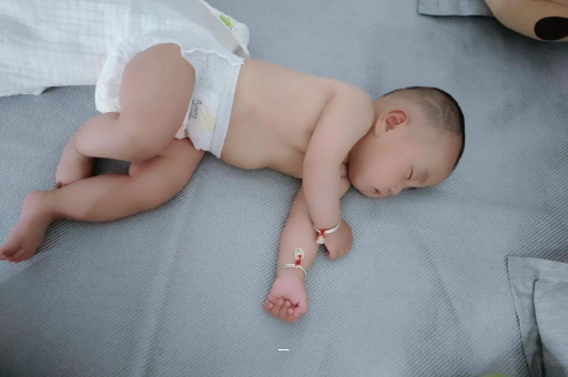 定州宝宝脸上有白色斑块 定州宝宝脸上有白色斑块